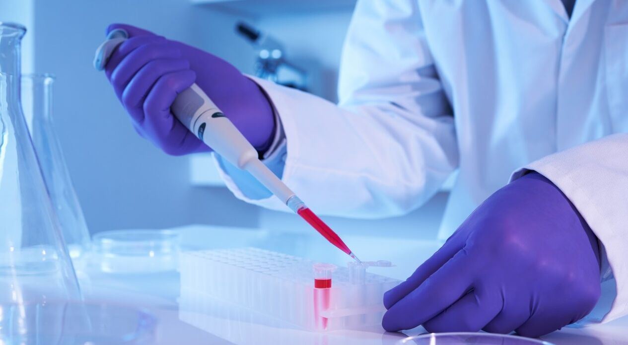 Comment prendre une analyse parasite