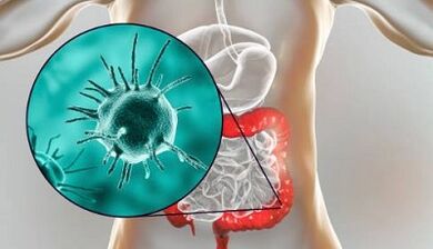 Quelles preuves prennent pour les parasites