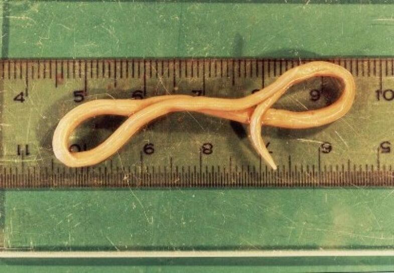 parasite ascaris du corps humain