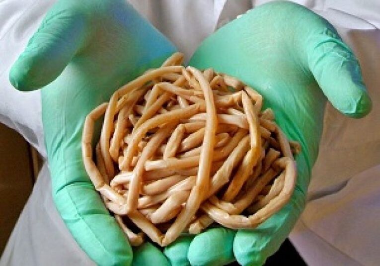 Vers parasites du corps humain.