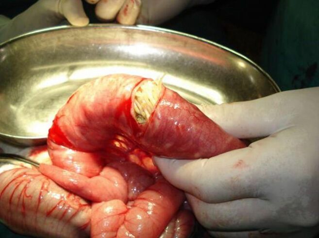 Les parasites Ches sont dangereux pour les humains.